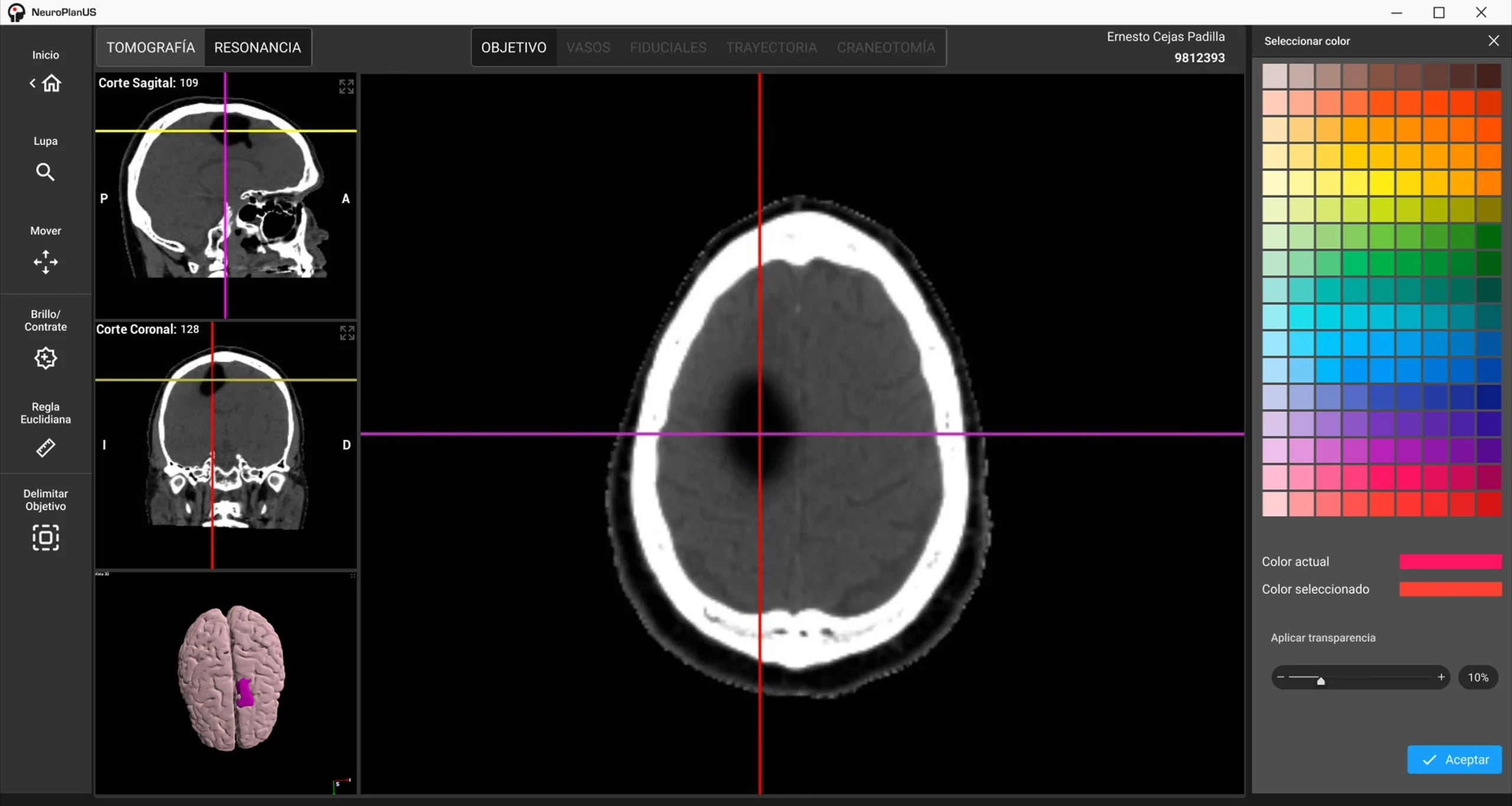NeuroPlanUs